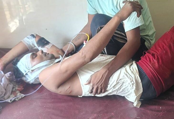 Leopard attacked a farmer in Lakhimpur | लखीमपुर में तेदुए ने किया किसान पर हमला: गन्ने के खेत में पानी लगा रहा था किसान, जिला अस्पताल रेफर – Bijua(Lakhimpur Kheri) News