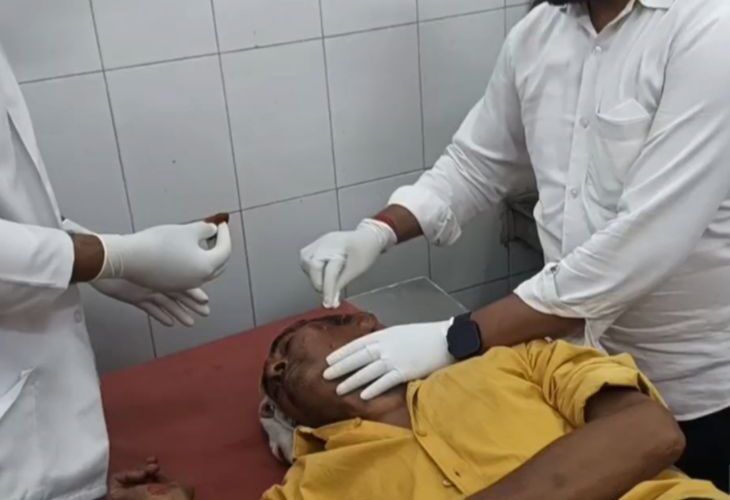 A jackal injured a gas agency guard | गैस एजेंसी के गार्ड पर सियार ने किया घायल: बागपत में गेट पर ड्यूटी करते समय हमला, चेहरे पर कई गंभीर घाव – Baghpat News
