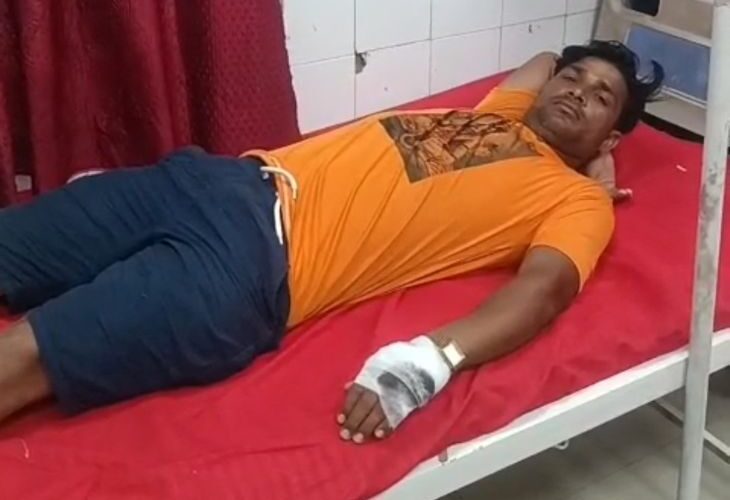 Dog attack on Kanwariyas in Hathras | हाथरस में कांवड़ियों पर कुत्ते का हमला: तीन कांवड़िया घायल, जिला अस्पताल में भर्ती; कुत्ता पागल होने की आशंका – Hathras News