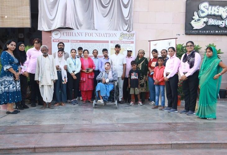 World Plastic Surgery Day celebrated in Lucknow Shiroz | लखनऊ शिरोज़ में मनाया गया विश्व प्लास्टिक सर्जरी दिवस: एसिड सरवाइवर्स ने साझा किया दर्द, डॉ राजीव बोले-एसिड पीड़ितों के लिए वरदान है प्लास्टिक सर्जरी – Lucknow News