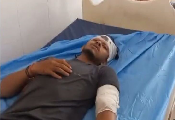A young man died when his bike collided with a divider in Kannauj | कन्नौज में डिवाइडर से बाइक टकराने पर युवक की मौत: आगरा-लखनऊ एक्सप्रेस-वे पर हुआ हादसा, दूसरा साथी गंभीर रूप से घायल – Bhunna(Tirwa) News