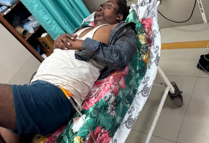 Uncontrolled car ran over 10 people in Lucknow | लखनऊ में बेकाबू कार ने 10 लोगों को रौंदा: लोगों ने ड्राइवर को दौड़ाकर पकड़ा, वाहन पर BJP का झंडा लगा था – Lucknow News