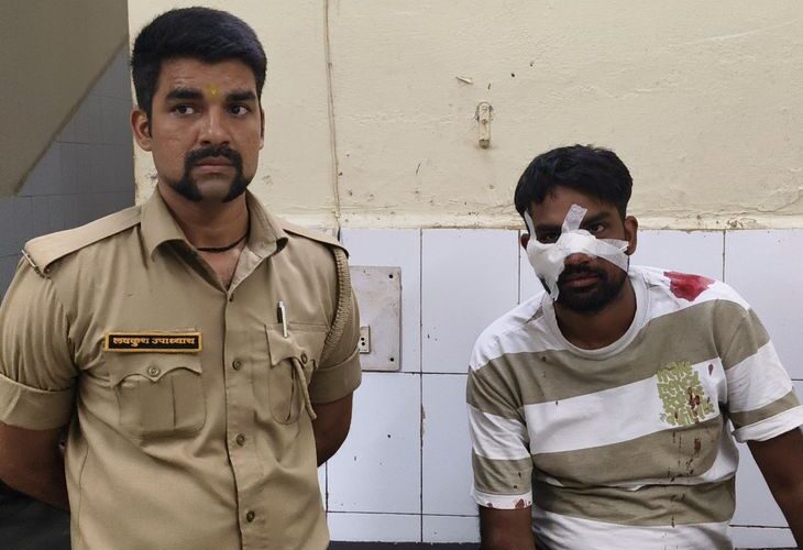 Teacher’s face cut with Chinese thread | चाइनीज मांझे से शिक्षक का चेहरा कटा: अलीगढ़ में भाई के रेलवे स्टेशन से घर जा रहा था शिक्षक, सारसौल के पास हुआ हादसा – Aligarh News